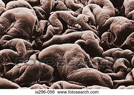 Stock Photograph - Gall bladder. Fotosearch