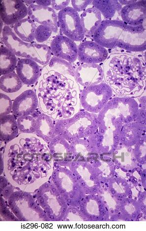 Glomeruli and tubules in kidney View Large Photo Image Stock Image - Glomeruli and tubules in kidney. Fotosearch
