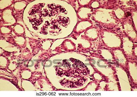 Glomeruli in kidney View Large Photo Image Stock Image - Glomeruli in kidney. Fotosearch