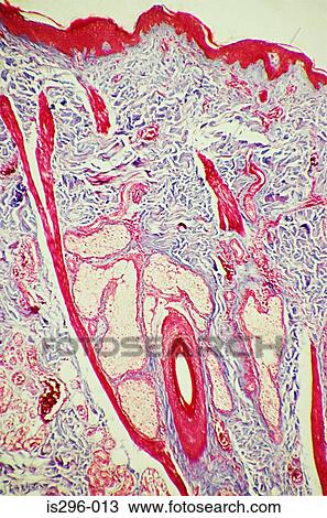Stock Image - Hair follicle in skin. Fotosearch