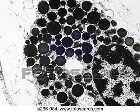 Picture - Mast cell. Fotosearch