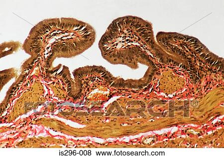 Stock Photo - Mucosa in gall bladder. Fotosearch
