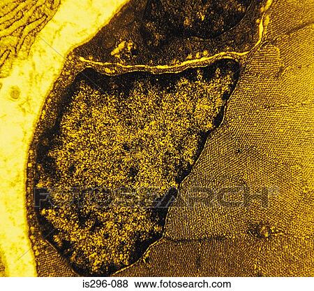 Stock Photo - Muscle cell. Fotosearch