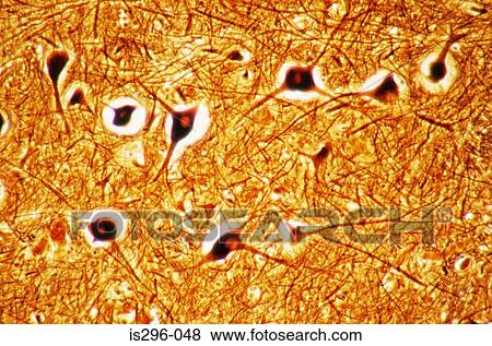 Stock Photo - Nerve cells in brain stem. Fotosearch
