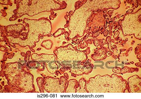 Placenta View Large Photo Image Stock Image - Placenta. Fotosearch