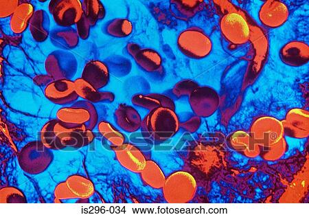 Red blood cells View Large Photo Image Picture - Red blood cells. Fotosearch