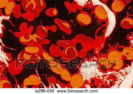 Red blood cells View Large Photo Image Stock Photography - Red blood cells. Fotosearch