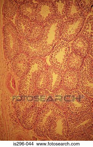 Seminiferous tubules in testis View Large Photo Image Picture - Seminiferous tubules in testis. Fotosearch