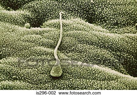 Sperm in uterus View Large Photo Image Stock Image - Sperm in uterus. Fotosearch