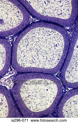 Stock Image - Tubules of sperm in epididymis. Fotosearch
