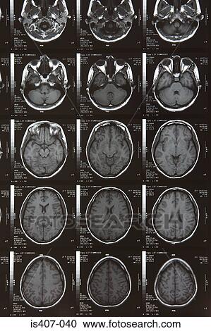 MRI scans View Large Photo Image Stock Image - MRI scans. Fotosearch