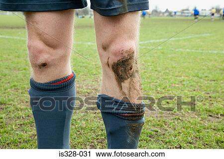 Footballer with cut and muddy knees View Large Photo Image Stock Image - Footballer with cut and muddy knees. Fotosearch