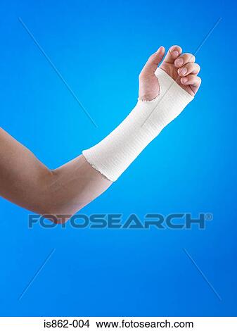 Man with bandage on wrist View Large Photo Image Picture - Man with bandage on wrist. Fotosearch