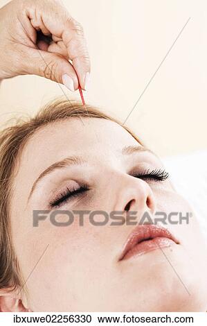 Acupuncture needle in the face of a young woman View Large Photo Image Stock Image - Acupuncture needle in the face of a young woman. Fotosearch
