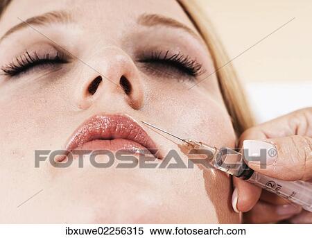 Stock Photography - "Syringe on the face of a patient, Botox treatment". Fotosearch