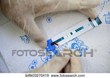 "AIDS rapid test with a drop of blood that is taken from the fingertip, Masaya, Departamento Masaya, Nicaragua, North America" View Large Photo Image Stock Photo - "AIDS rapid test with a drop of blood that is taken from the fingertip, Masaya, Departamento Masaya, Nicaragua, North America". Fotosearch