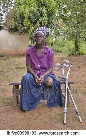 Stock Image - "Amputee, Motema Amputee Camp, Koidu, Koidu-Sefadu, Kono District, Eastern Province, Sierra Leone, Africa". Fotosearch