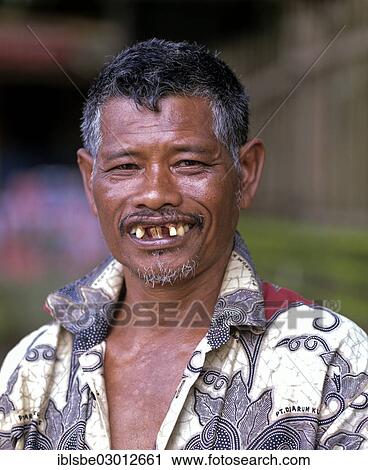 "Balinese man smiling with bad teeth, tooth loss, Bali, Indonesia, Asia" View Large Photo Image Stock Image - "Balinese man smiling with bad teeth, tooth loss, Bali, Indonesia, Asia". Fotosearch