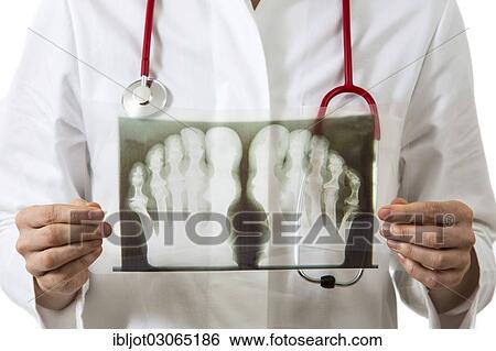 "Female doctor looking at an X-ray, feet, toes" View Large Photo Image Stock Photograph - "Female doctor looking at an X-ray, feet, toes". Fotosearch
