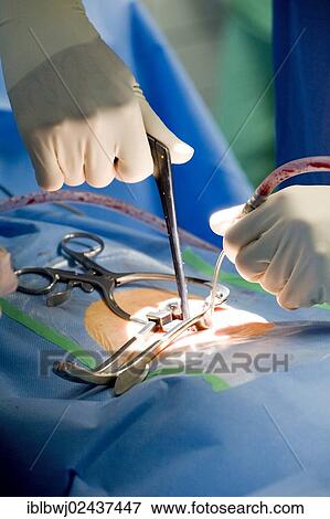 "Hands of a neurosurgeon during spinal surgery in an operating room, Oberschwaben Klinik St. Elisabeth Hospital, Ravensburg, Baden-Wuerttemberg, Germany, Europe" View Large Photo Image Stock Photo - "Hands of a neurosurgeon during spinal surgery in an operating room, Oberschwaben Klinik St. Elisabeth Hospital, Ravensburg, Baden-Wuerttemberg, Germany, Europe". Fotosearch