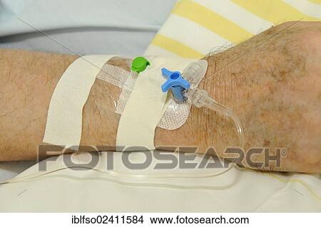 Picture - Infusion catheter in the hand of a patient, intensive care unit, hospital, Germany, Europe. Fotosearch