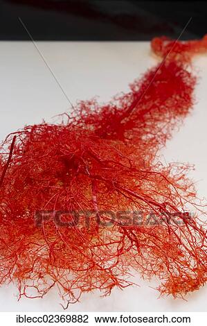 Stock Image - Plastination specimen of arteries of arm. Fotosearch
