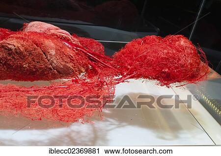 Plastination specimen of arteries of upper body View Large Photo Image Stock Image - Plastination specimen of arteries of upper body. Fotosearch
