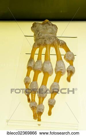Stock Photograph - Plastination specimen of bones and joints of hand. Fotosearch
