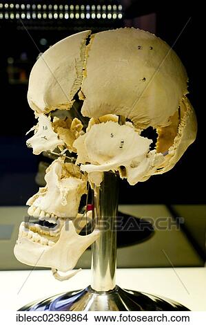 Picture - Plastination specimen of bones of the cranium. Fotosearch