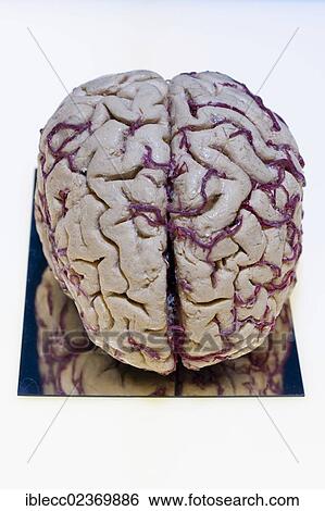 Stock Photograph - Plastination specimen of brain. Fotosearch