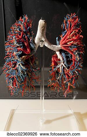 "Plastination specimen of bronchial distribution, trachea and bronchi, in white; lungs, arteries in blue and veins in red" View Large Photo Image Stock Photograph - "Plastination specimen of bronchial distribution, trachea and bronchi, in white; lungs, arteries in blue and veins in red". Fotosearch