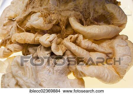 Picture - Plastination specimen of digestive system. Fotosearch