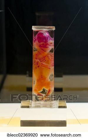 Stock Image - Plastination specimen of fetus. Fotosearch
