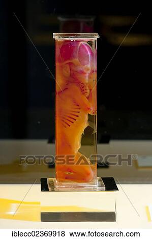 Plastination specimen of fetus View Large Photo Image Stock Photo - Plastination specimen of fetus. Fotosearch