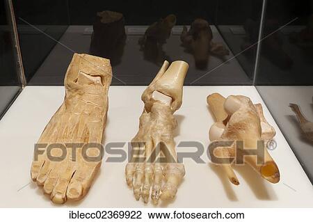 Plastination specimen of human foot with and without skin and a knee View Large Photo Image Stock Image - Plastination specimen of human foot with and without skin and a knee. Fotosearch
