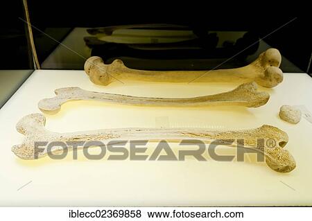 Plastination specimen of human thighbones View Large Photo Image Stock Photo - Plastination specimen of human thighbones. Fotosearch
