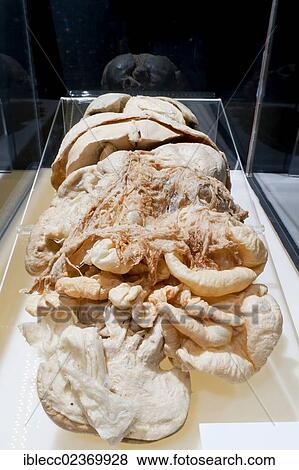 Plastination specimen of human abdominal and thoracic organs View Large Photo Image Stock Photo - Plastination specimen of human abdominal and thoracic organs. Fotosearch