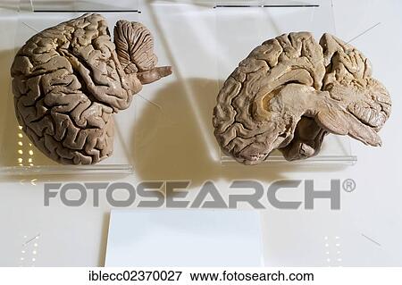 Plastination specimen of midsagittal cut of human brain View Large Photo Image Stock Photo - Plastination specimen of midsagittal cut of human brain. Fotosearch