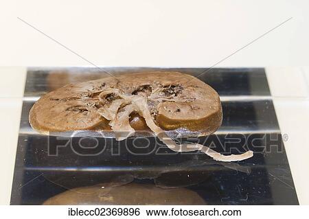 Stock Photograph - Plastination specimen of midsagittal cut of cerebellum. Fotosearch