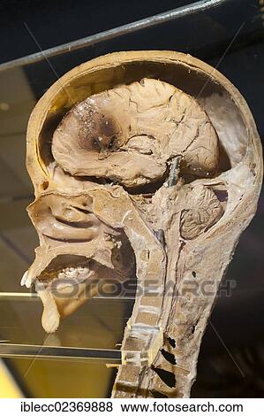Plastination specimen of sagital section of head and neck View Large Photo Image Stock Photo - Plastination specimen of sagital section of head and neck. Fotosearch