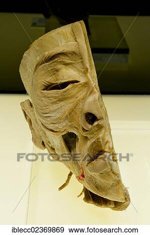Plastination specimen of sagittal section of head showing the muscles of facial expression and muscles involved in mastication View Large Photo Image Stock Photo - Plastination specimen of sagittal section of head showing the muscles of facial expression and muscles involved in mastication. Fotosearch