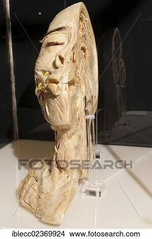 Plastination specimen of section of a human head and neck View Large Photo Image Picture - Plastination specimen of section of a human head and neck. Fotosearch
