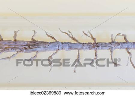 Plastination specimen of spinal cord View Large Photo Image Stock Photo - Plastination specimen of spinal cord. Fotosearch