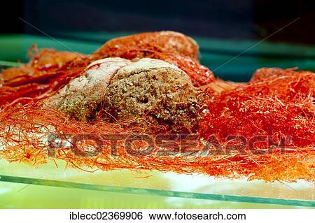 Plastination specimen of vessels of thorax and abdominal cavity View Large Photo Image Stock Photograph - Plastination specimen of vessels of thorax and abdominal cavity. Fotosearch