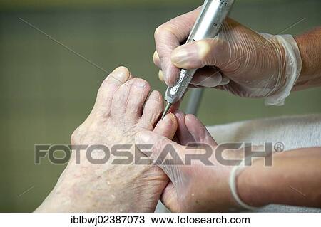 "Podiatrist, medicinal podiatry, cleaning and polishing of toenails" View Large Photo Image Stock Image - "Podiatrist, medicinal podiatry, cleaning and polishing of toenails". Fotosearch