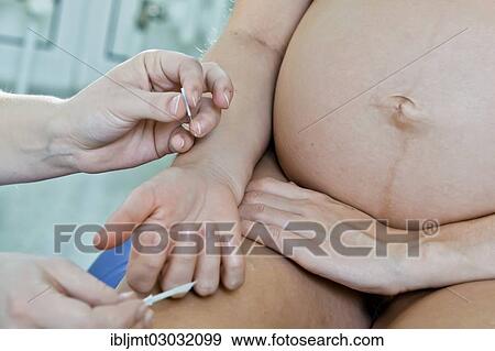 "Pregnant woman recieving acupuncture from her midwife during delivery, Germany, Europe" View Large Photo Image Stock Photo - "Pregnant woman recieving acupuncture from her midwife during delivery, Germany, Europe". Fotosearch
