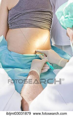 "Pregnant women during delivery in the delivery room with an anesthesiologist applying a PDA or epidural, Germany, Europe" View Large Photo Image Stock Photo - "Pregnant women during delivery in the delivery room with an anesthesiologist applying a PDA or epidural, Germany, Europe". Fotosearch