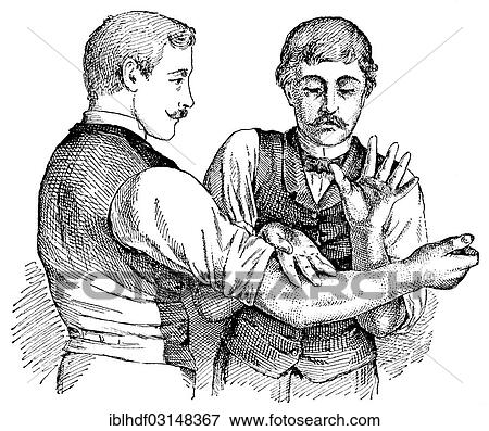 "Tapotement massage technique, state of the art of therapeutic techniques, early 20th Century, illustration" View Large Photo Image Stock Photo - "Tapotement massage technique, state of the art of therapeutic techniques, early 20th Century, illustration". Fotosearch