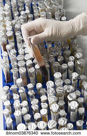 "Test tubes with samples in a medical laboratory, Germany, Europe" View Large Photo Image Stock Image - "Test tubes with samples in a medical laboratory, Germany, Europe". Fotosearch