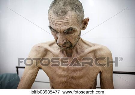 Stock Photo - "Tuberculosis and HIV in Moldova, TB ward, Hospital, Balti, Moldova, Europe". Fotosearch